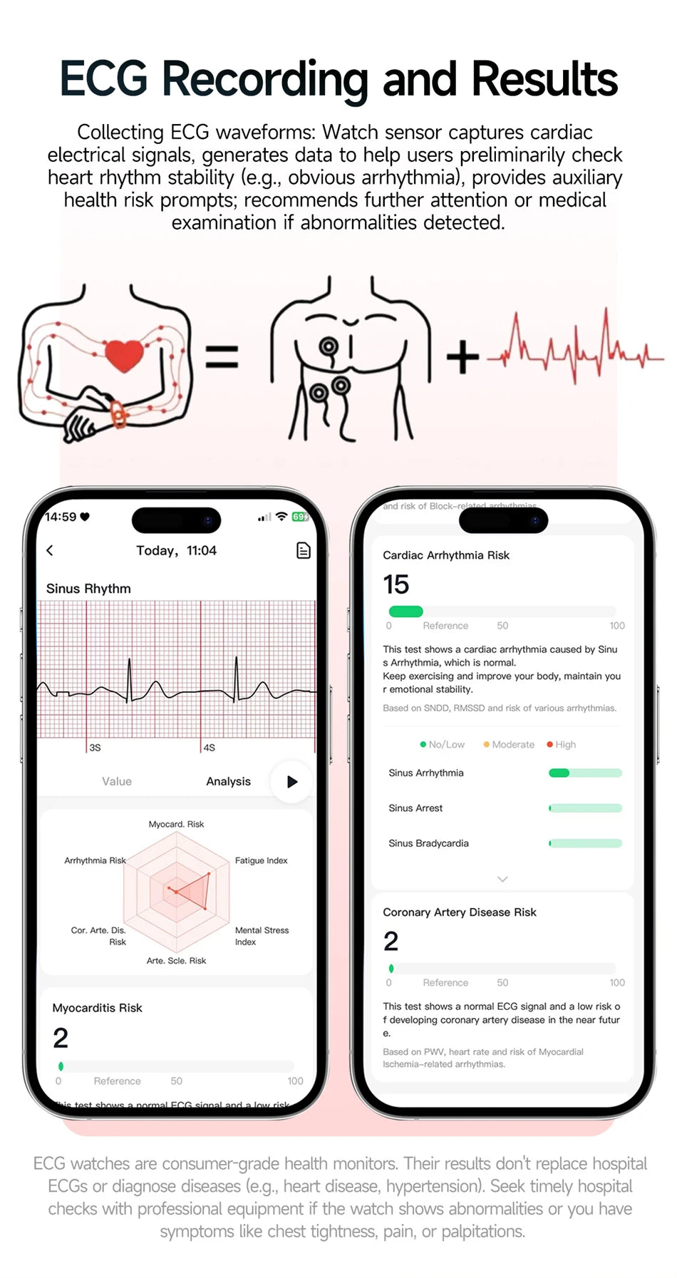 2026 Advanced ECG Smartwatch with Bluetooth Call – Uric Acid & Lipid Health Monitor, 2.01" Screen, Built-in Flashlight, Unisex Fitness Watch