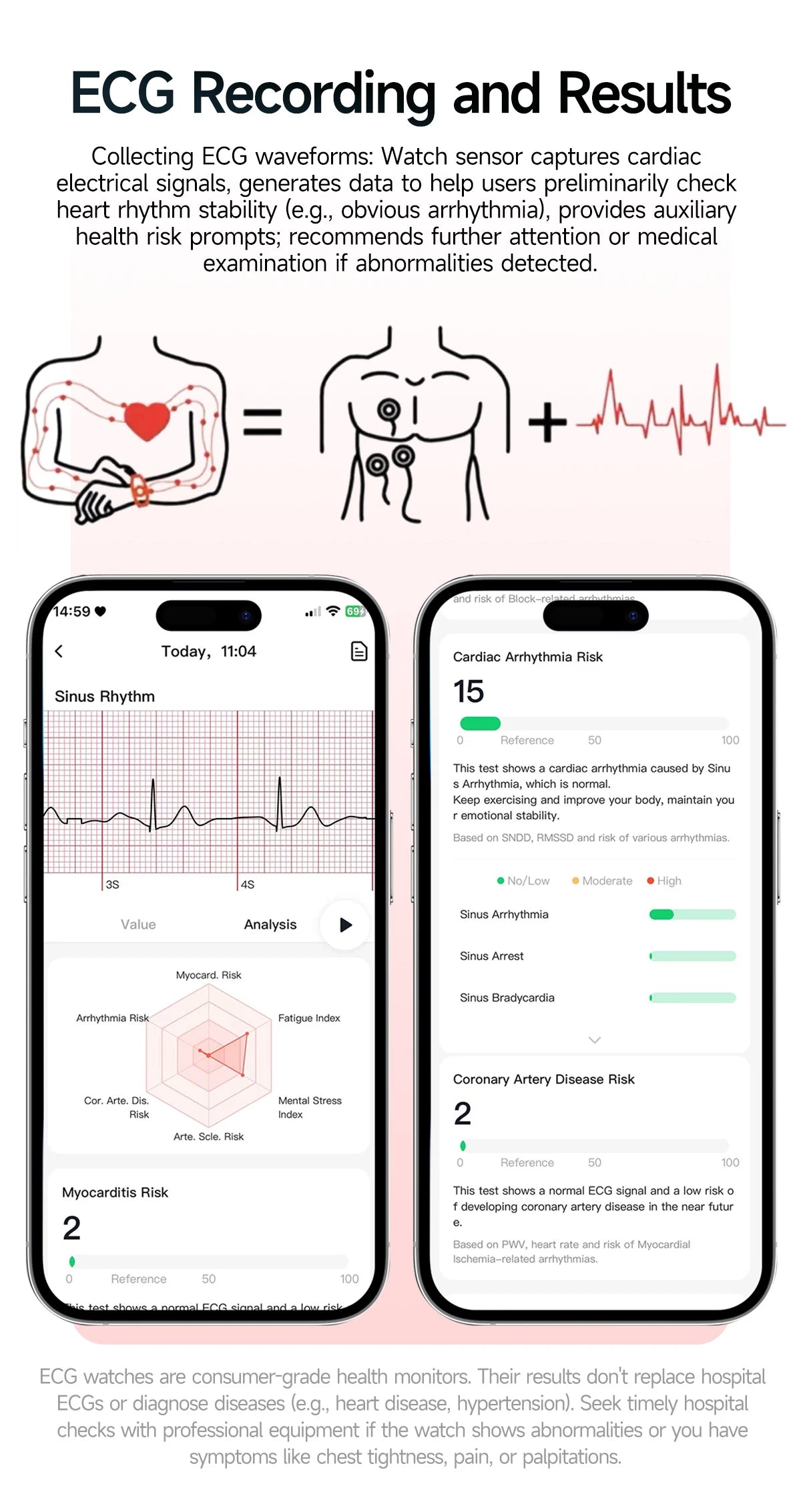 2026 Pro Health Smart Watch – ECG, PPG & Blood Pressure Monitor, Body Analysis, Lipid & Uric Acid Tracker, Unisex Fitness Smartwatch