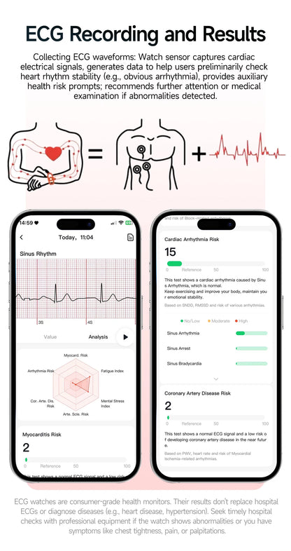 2026 Pro Health Smart Watch – ECG, PPG & Blood Pressure Monitor, Body Analysis, Lipid & Uric Acid Tracker, Unisex Fitness Smartwatch